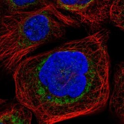 Bad Antibody, Novus Biologicals 0.1mL; Unlabeled:Antibodies, Polyclonal